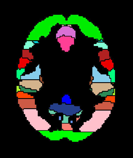 _images/overlays_label1.png