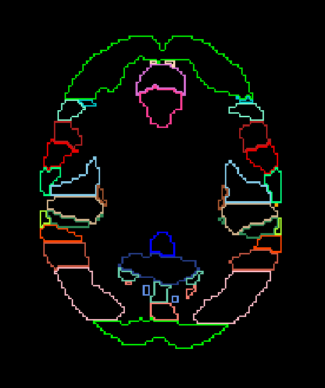 _images/overlays_label2.png