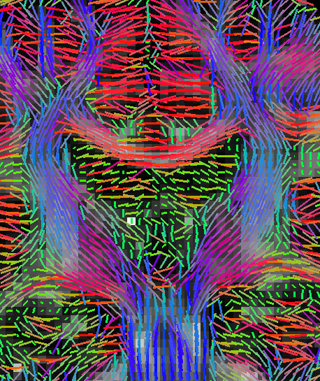 _images/overlays_linevector2.png