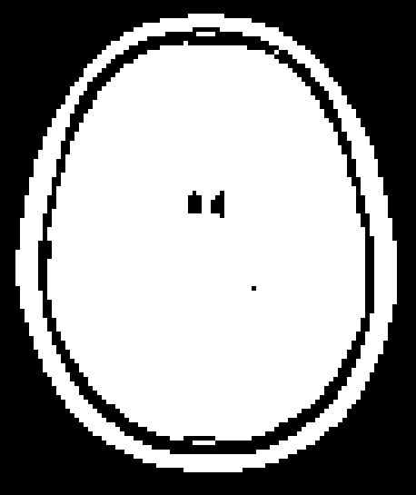 _images/overlays_mask1.png