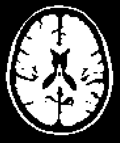 _images/overlays_mask2.png
