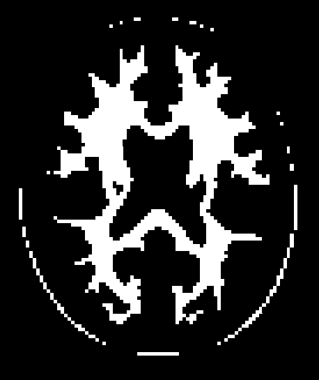 _images/overlays_mask3.png