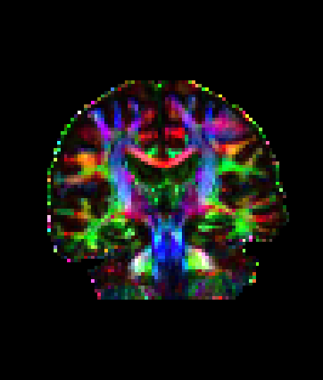 _images/overlays_rgbvector2.png