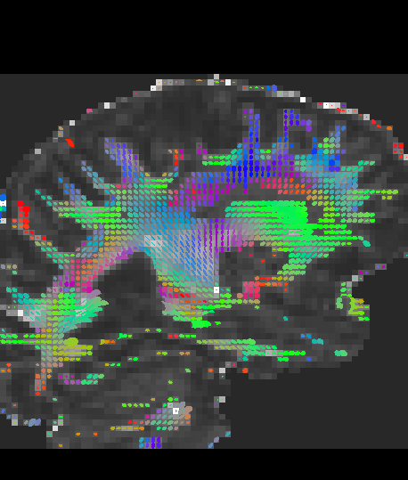 _images/overlays_tensor2.png