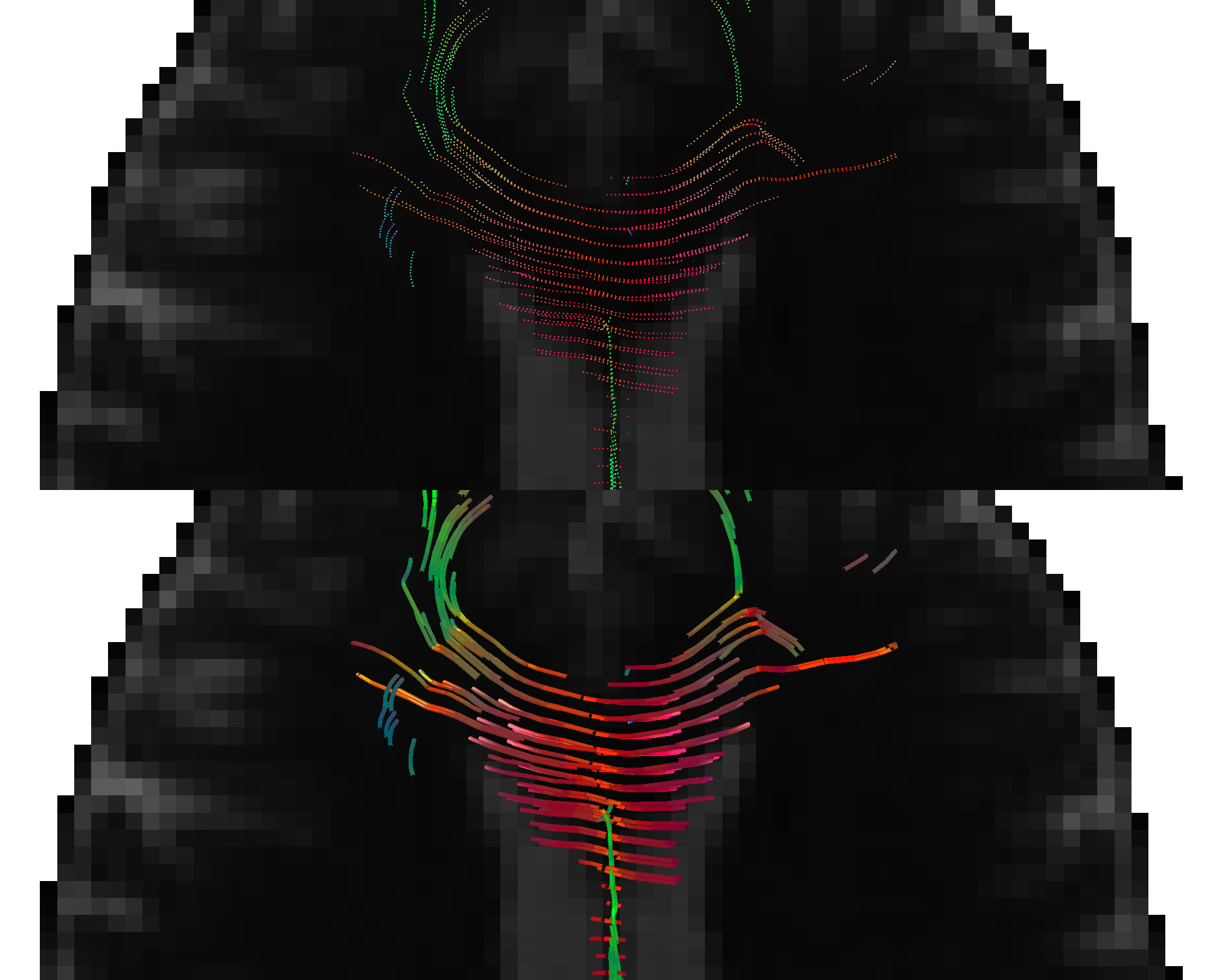 _images/overlays_tractogram_pseudo3d.png