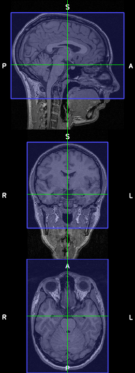 _images/tools_crop_image_example.png